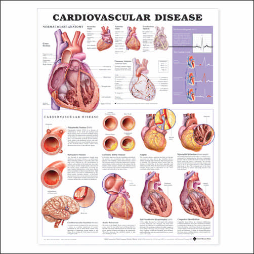 cardiovascular-disease-anatomical-chart
