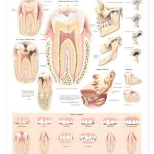 Disorders of the Teeth and Jaw Anatomical Chart