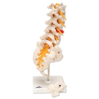 lumbar-spinal-column-prolapsed-disc