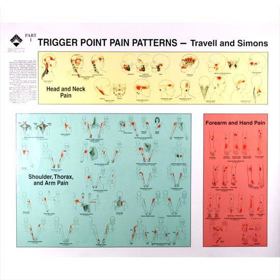 Trigger Point Pain Patterns Charts Bytravell And Simons Physio Needs