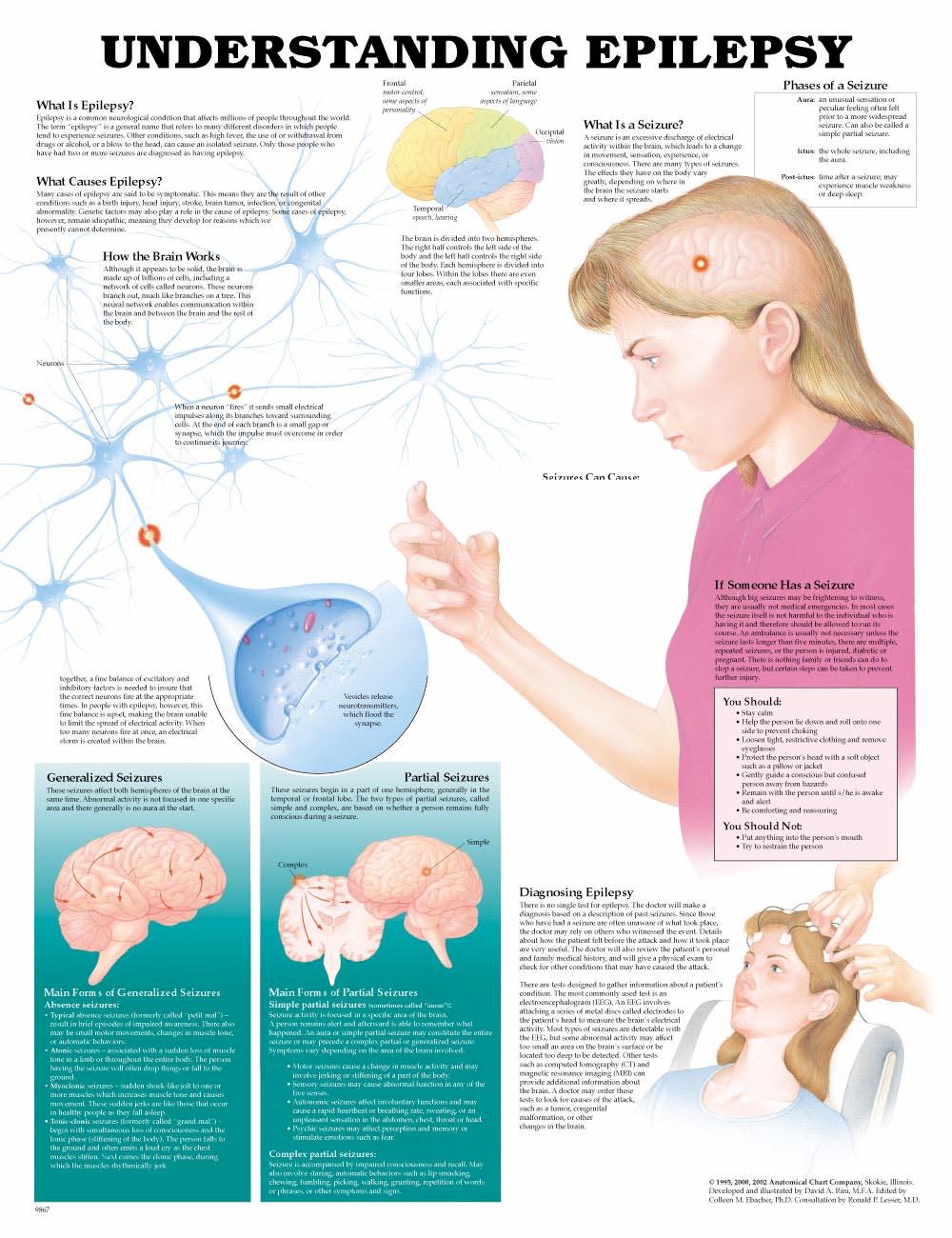 understanding-epilepsy-anatomical-chart