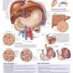 Understanding Hepatitis Educational Chart
