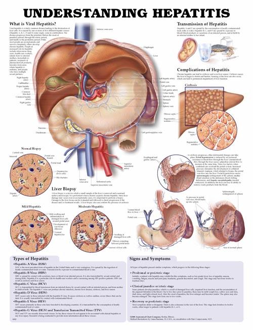 understanding-hepatitis-educational-poster