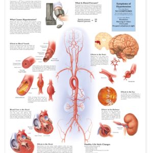 Understanding Hypertension Anatomical Chart